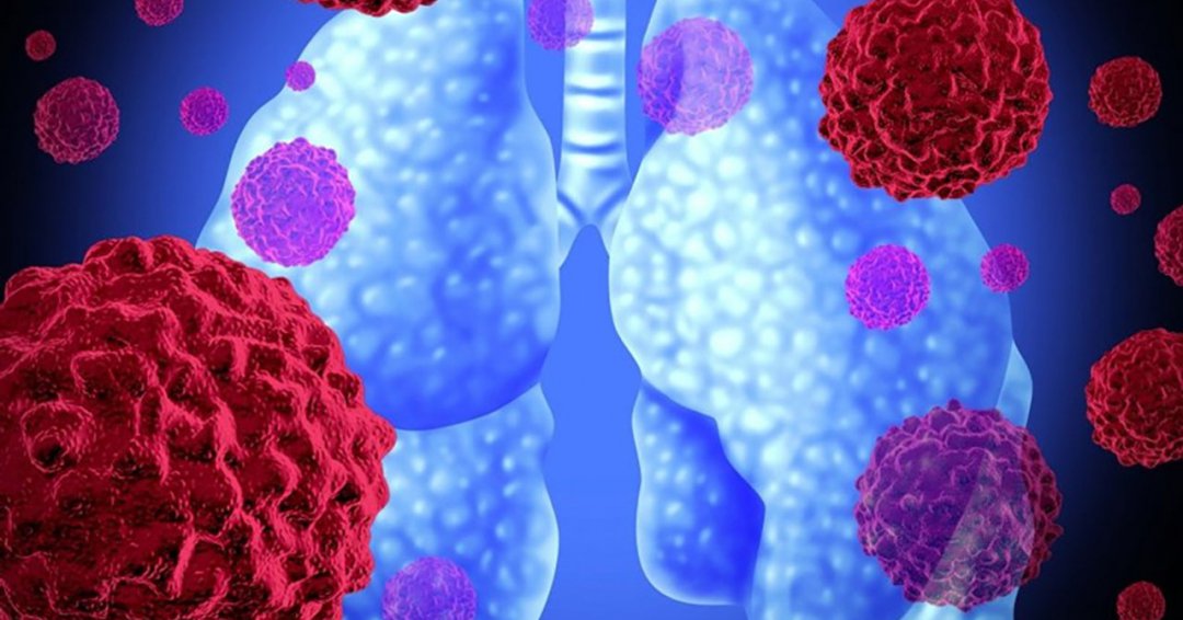 Nhiễm trùng nấm