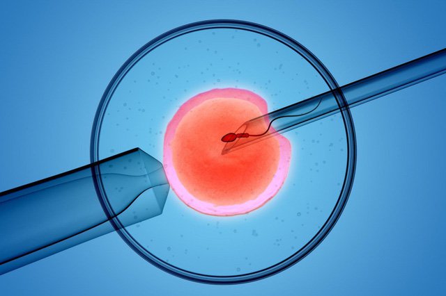 Thụ tinh trong ống nghiệm IVF