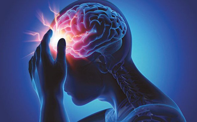 Phân biệt giữa bệnh thiếu máu não và rối loạn tiền đình - ảnh 3