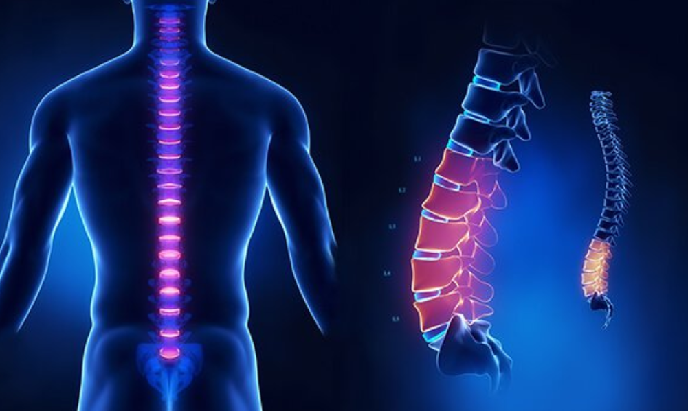 MRI cột sống thắt lưng