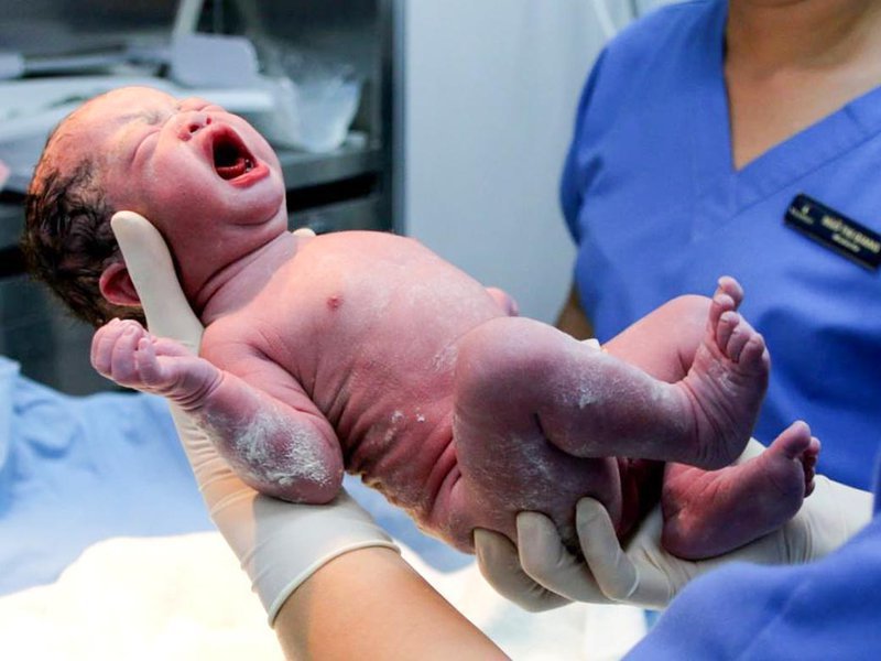 Đẻ không đau ở Vinmec - Vượt cạn nhẹ nhàng, sinh con khỏe mạnh