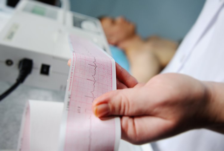 ECG điện tim điện tâm đồ