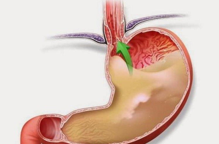 Dịch vị: Đặc tính và tác dụng - ảnh 3