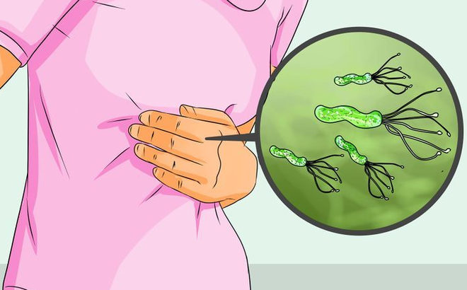 Cắt dạ dày do ung thư: Những điều cần lưu ý - ảnh 2