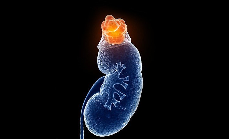 Ý nghĩa chỉ số xét nghiệm ACTH đánh giá bệnh Addison và hội chứng Cushing - ảnh 4
