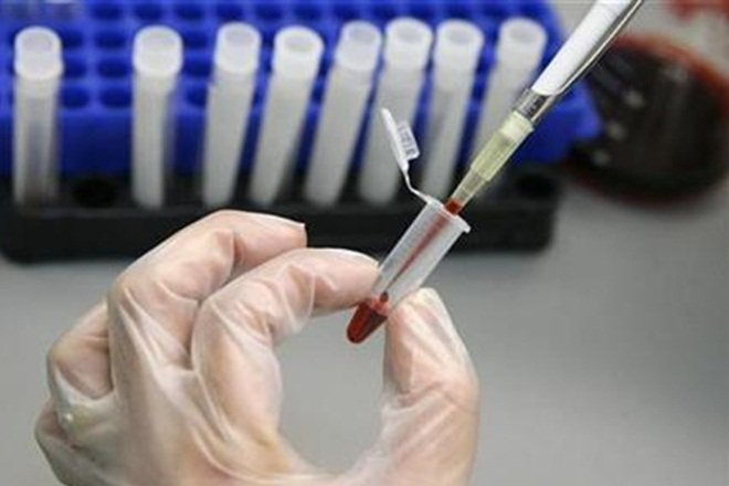 Xét nghiệm axit nucleic (Nucleic Acid Test - NAT)