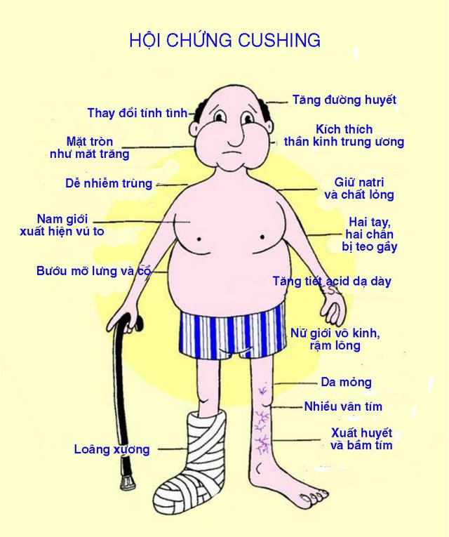 Ý nghĩa chỉ số xét nghiệm ACTH đánh giá bệnh Addison và hội chứng Cushing - ảnh 3