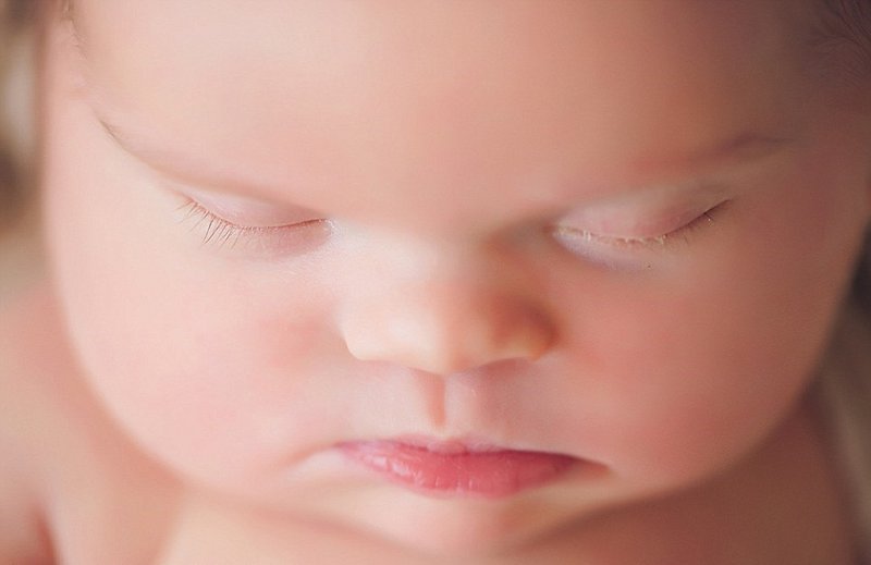 Tắc tá tràng ở trẻ sơ sinh: Chẩn đoán và điều trị - ảnh 1