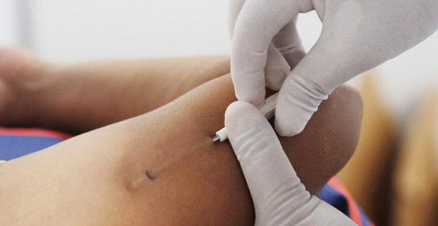 Tháo que tránh thai