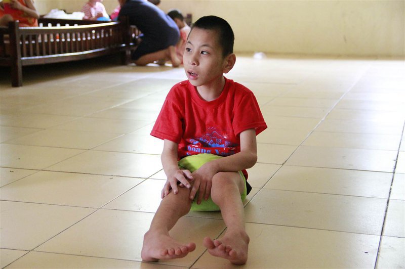 Bại liệt