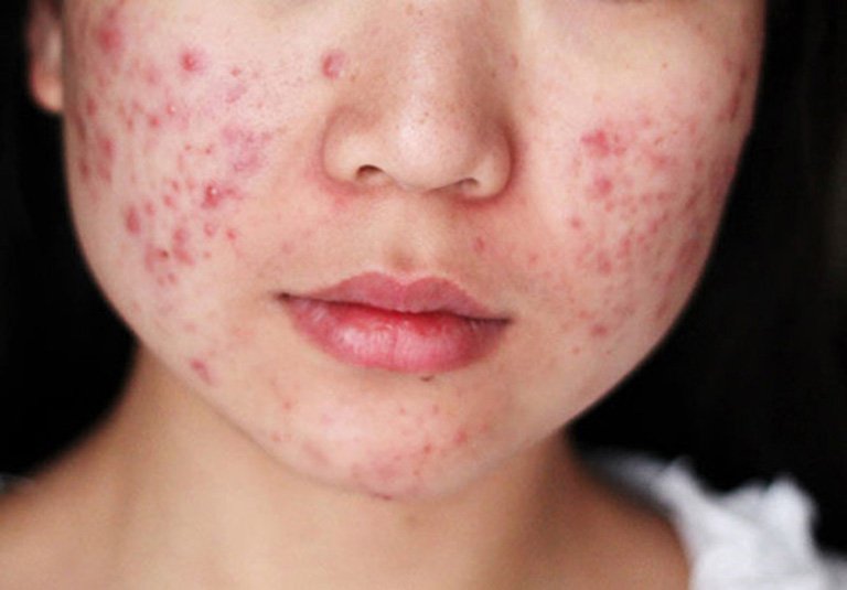 Bệnh nội tiết ở phụ nữ nguyên nhân vô sinh hiếm muộn - ảnh 2