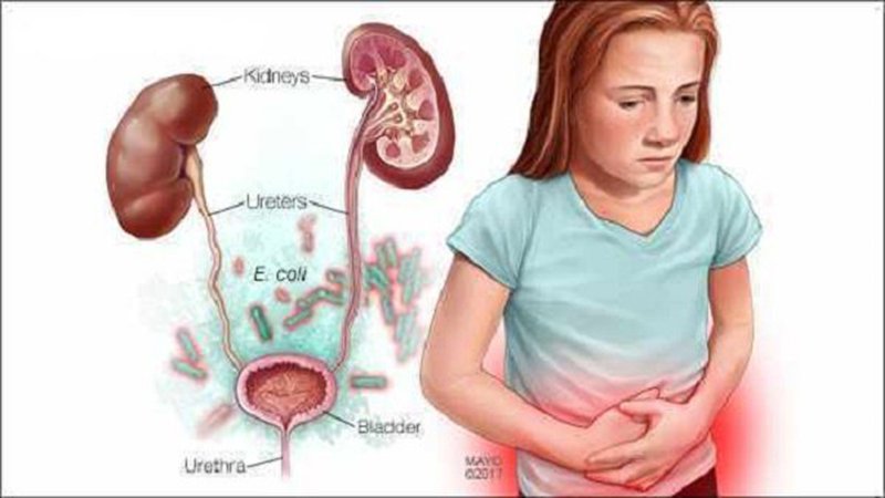 Điều trị dị tật còn ổ nhớp lộ ngoài ở trẻ - ảnh 2