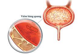 Virus Adenovirus gây bệnh gì? - ảnh 4