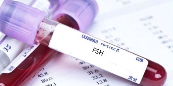 Chỉ số FSH như thế nào là bình thường?