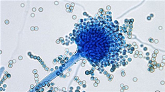 Aspergillus