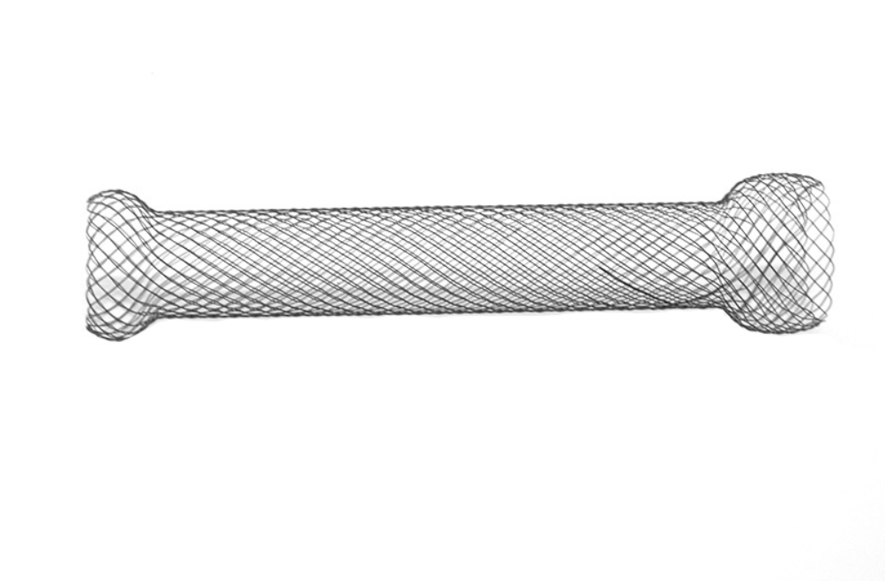 Đặt stent điều trị ung thư thực quản giai đoạn cuối - ảnh 4