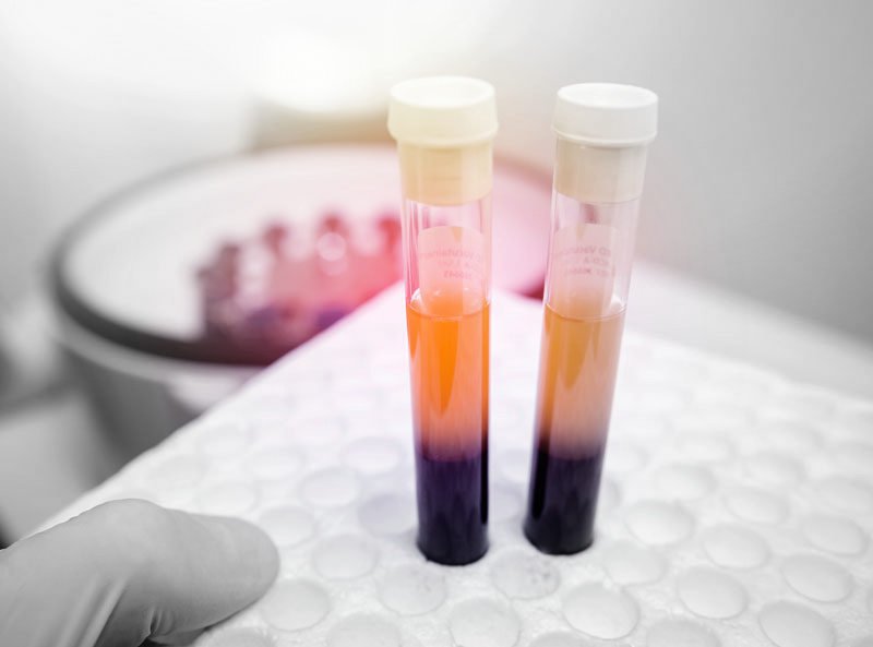 Huyết tương là gì? Chức năng của huyết tương