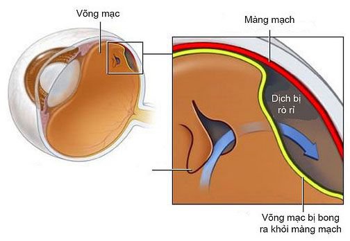 Phẫu thuật điều trị vết thương mạch đốt sống - ảnh 1