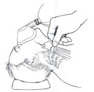 Phác đồ gây mê dạ dày đầy - ảnh 2