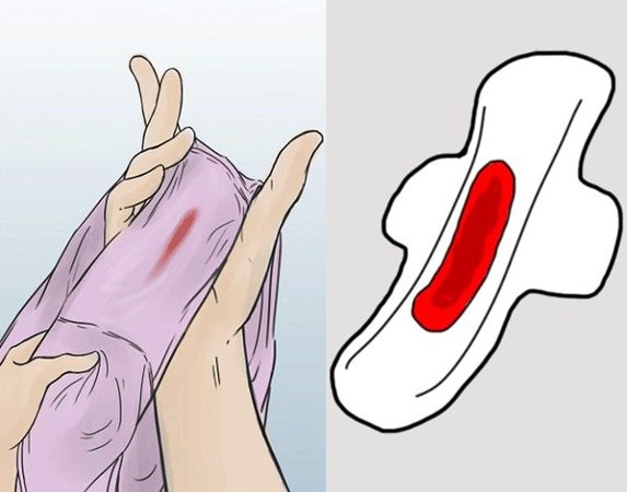 triệu chứng đầu tiên có thể là ra máu âm đạo bất thường
