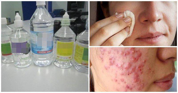 Nước muối sinh lý có thể sát khuẩn không?