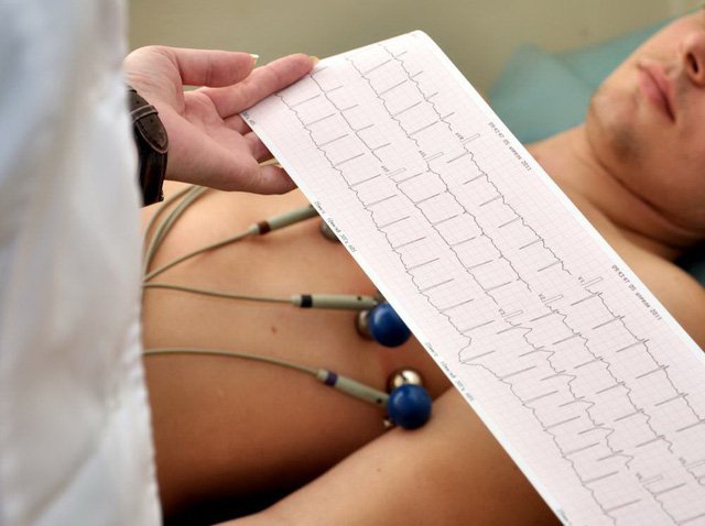 ECG điện tim điện tâm đồ
