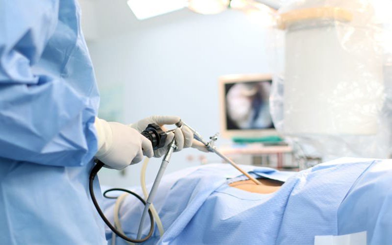 nội soi sau phúc mạc lấy sỏi