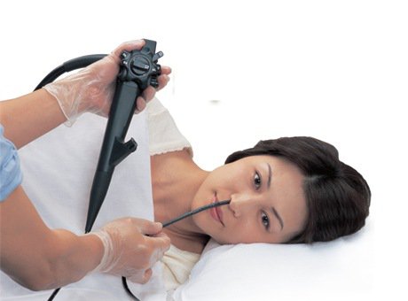 Nội soi dạ dày qua đường mũi