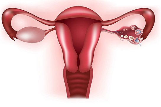 Các biến chứng có thể gặp của suy buồng trứng sớm