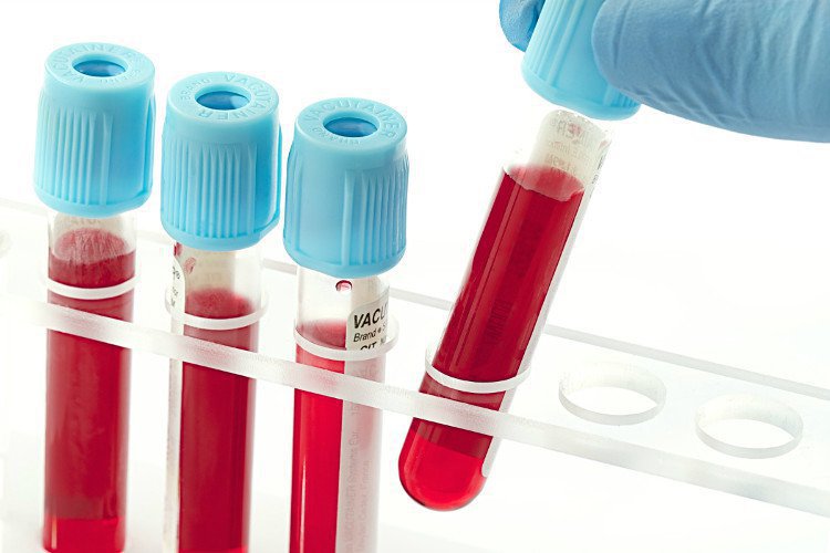 Bệnh Crohn ở trẻ em và thiếu niên - ảnh 3