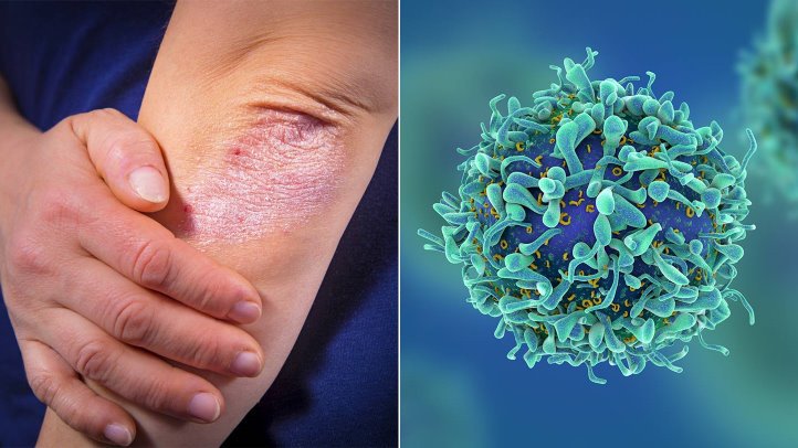 Tiêm corticoid vào khớp có hại gì? và Những điều cần lưu ý - ảnh 3