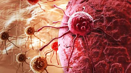 Tế bào ung thư ruột kết