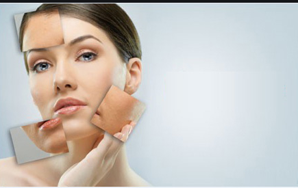 Tái tạo bề mặt da