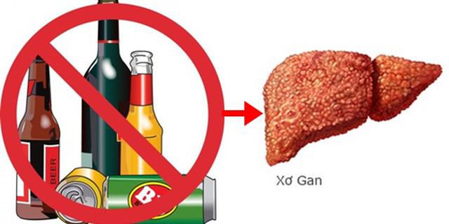 Điều trị bệnh xơ gan do rượu bằng phương pháp ghép tế bào gốc được không?