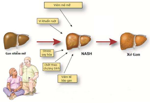 NASH