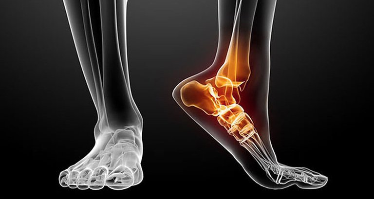 Trường hợp trật khớp được chỉ định chụp cộng hưởng từ có tiêm thuốc đối quang từ