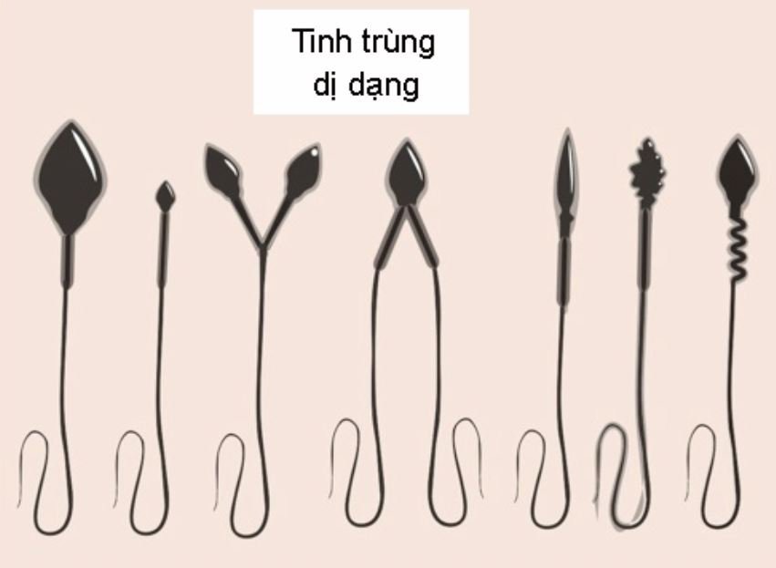 DỊ dạng tinh trùng