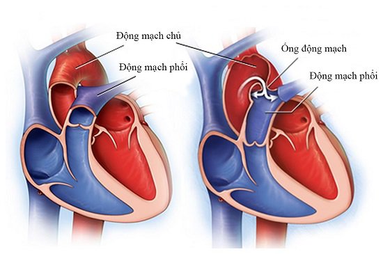 Tim có cấu tạo 4 khoang rỗng