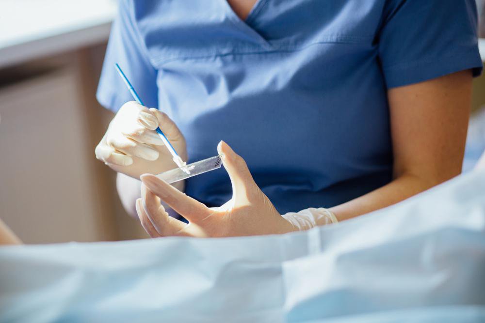 Pap Smear Test