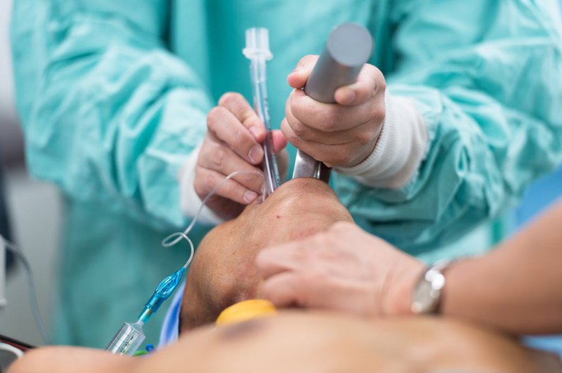 Bệnh nhân được gây mê toàn thân khi phẫu thuật