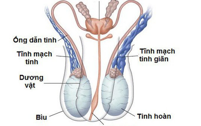 Giãn tĩnh mạch thừng tinh