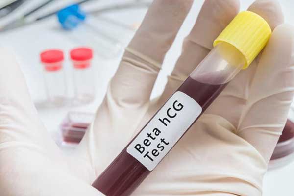 Chỉ số Beta HCG
