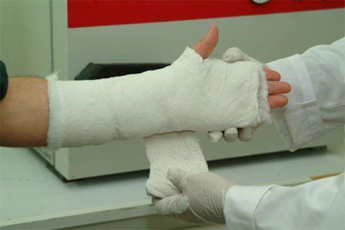 Phục hồi chức năng sau gãy xương cẳng tay