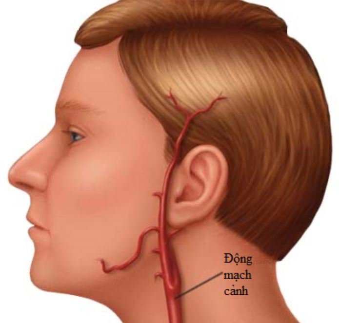 Động mạch cảnh