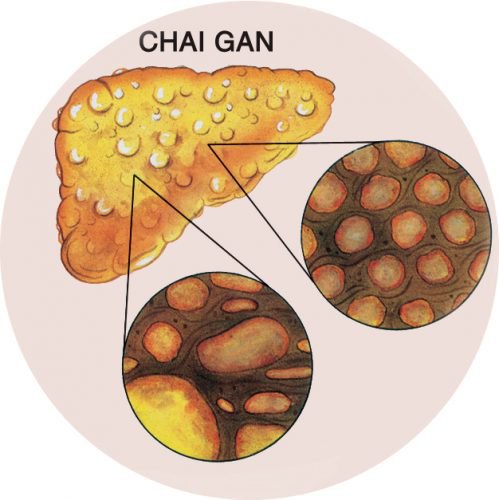 chai-gan-va-nhung-dieu-can-biet-1