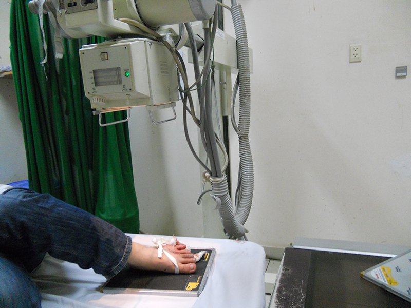 chụp x-quang bàn chân