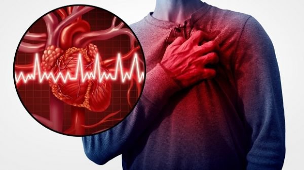 Các phương pháp điều trị suy tim giai đoạn 3