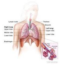 Kỹ thuật đặt stent khí phế quản