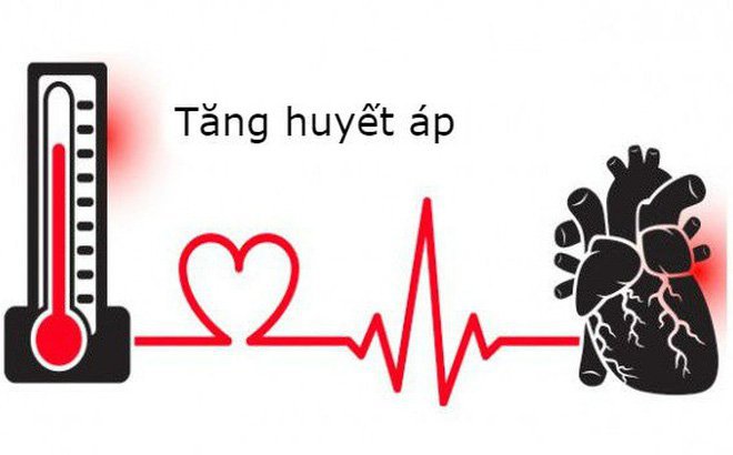 Phục hồi chức năng chống chỉ định đối với bệnh nhân mắc tăng huyết áp nặng