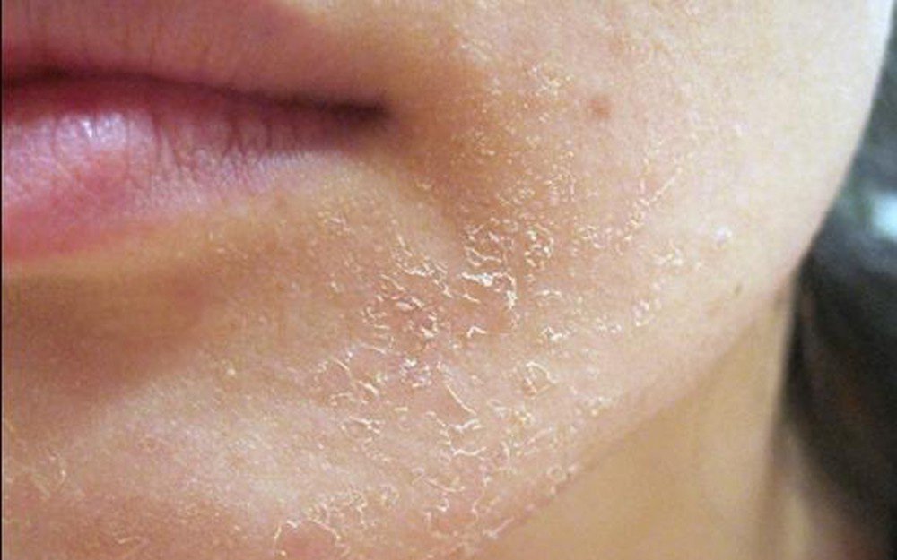 11 cách giảm lão hóa da sớm - ảnh 1